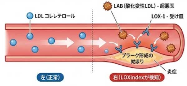 心血管ドック