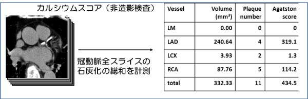心血管ドック