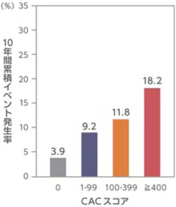 心血管ドック
